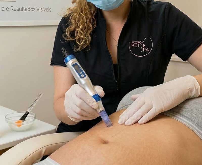 Micropuntura Brasileña