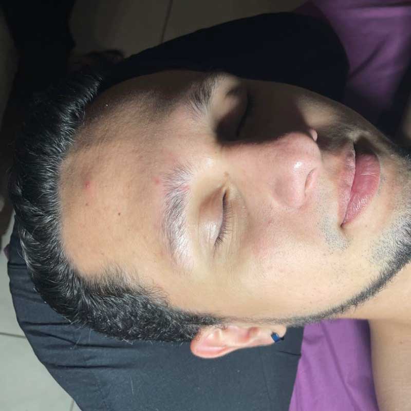 Después del tratamiento facial masculino